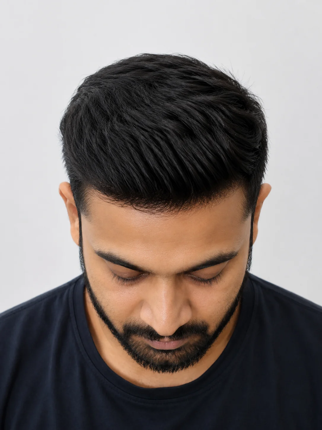 Hair Patch Transformation after