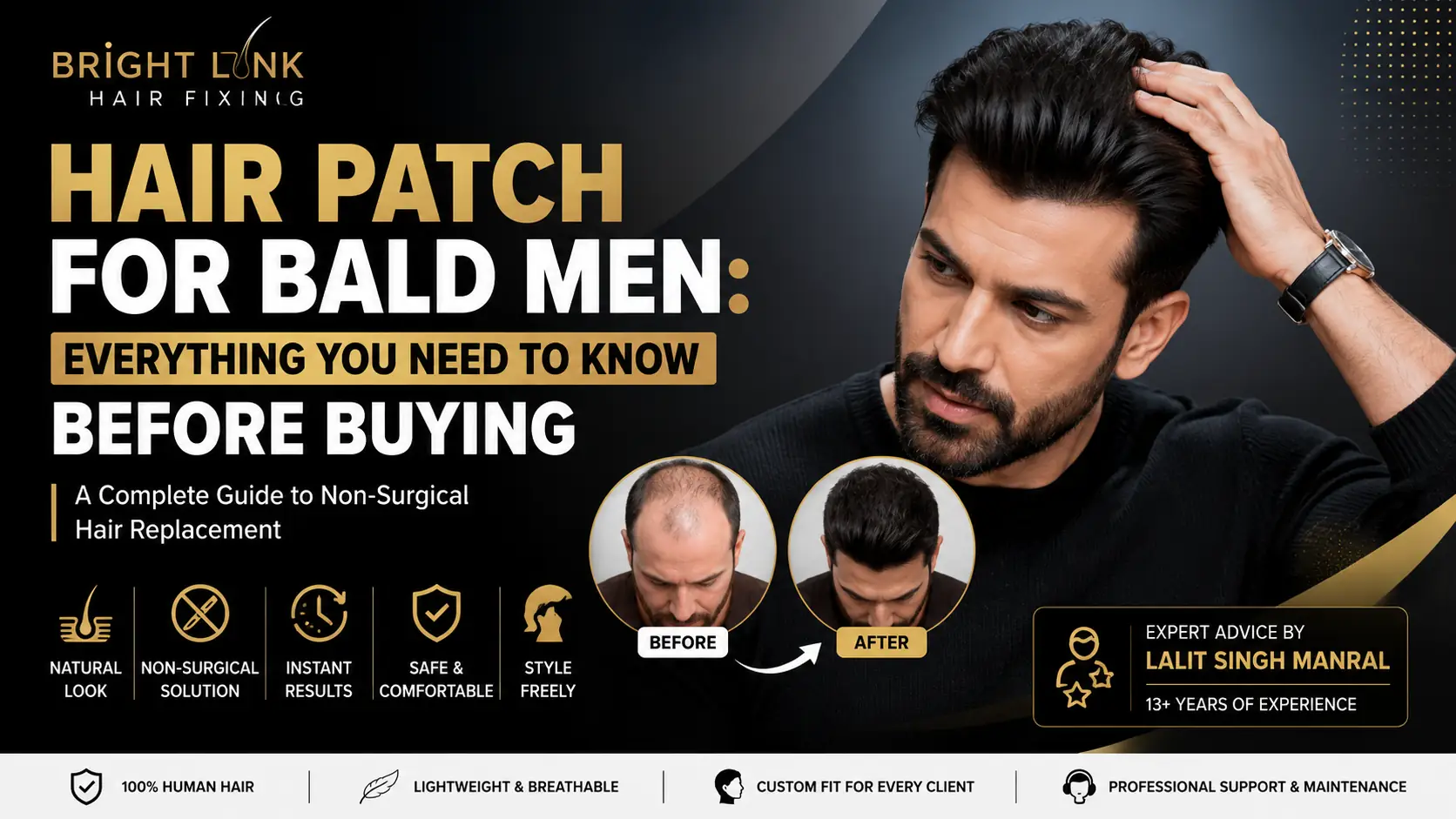 Hair Patch for Bald Men: Everything You Need to Know Before Buying