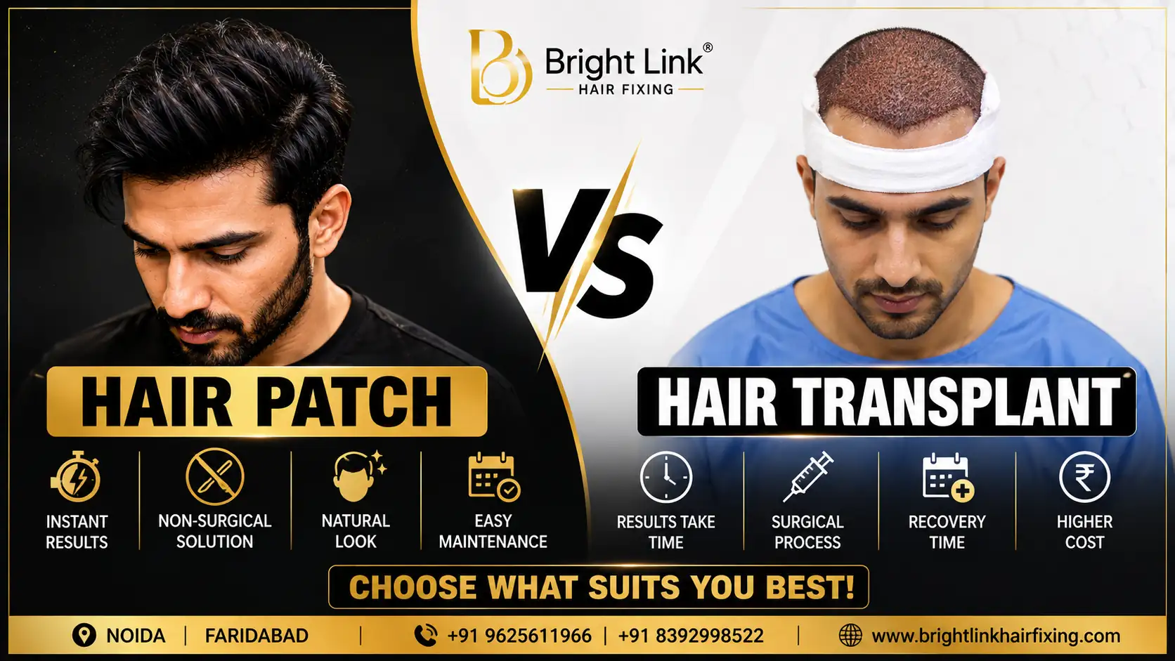 Hair Patch vs Hair Transplant: Which Option Is Better for You?