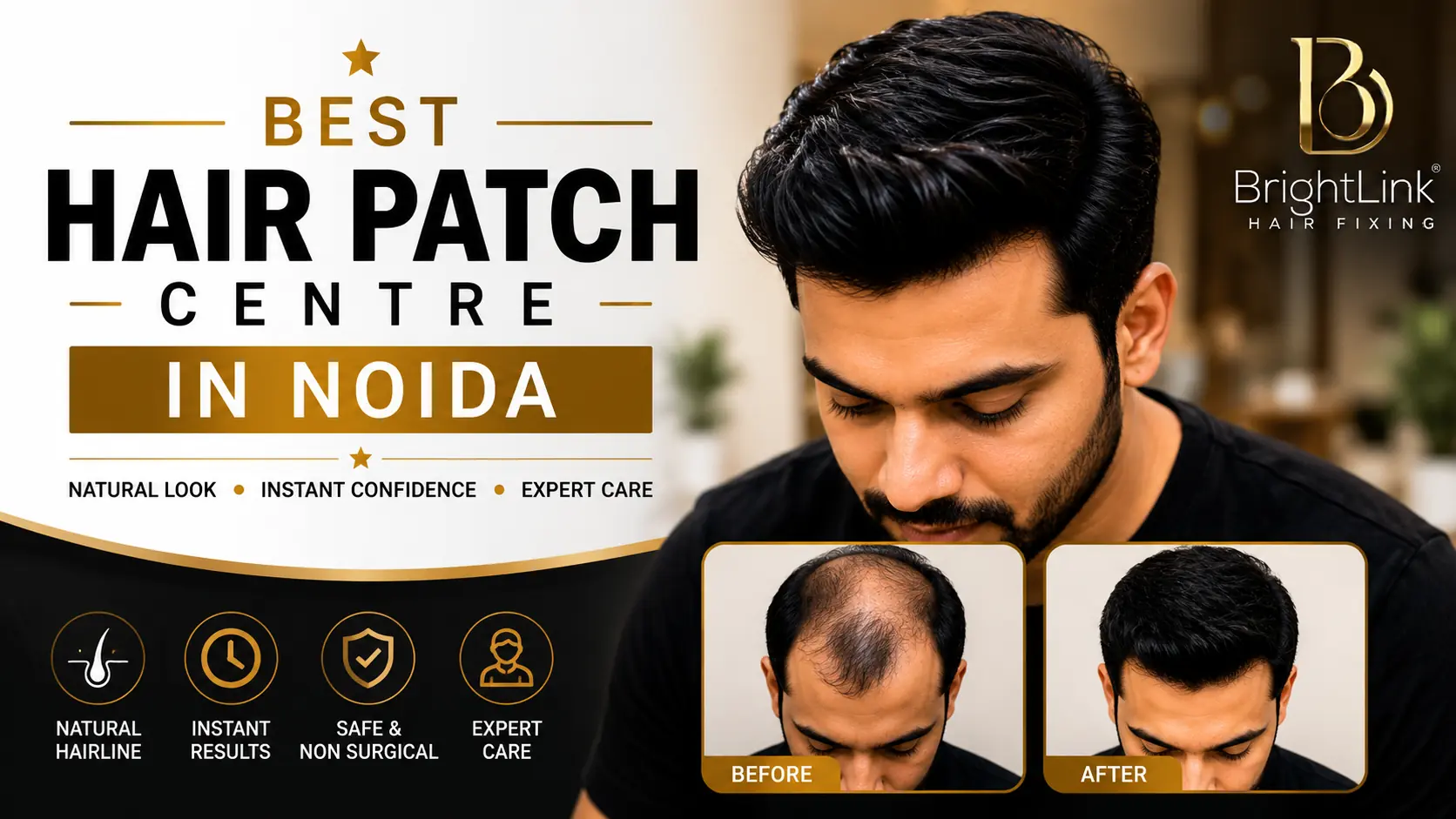 Best Hair Patch Centre in Noida – A Complete Guide to Choosing the Right Hair Replacement Solution