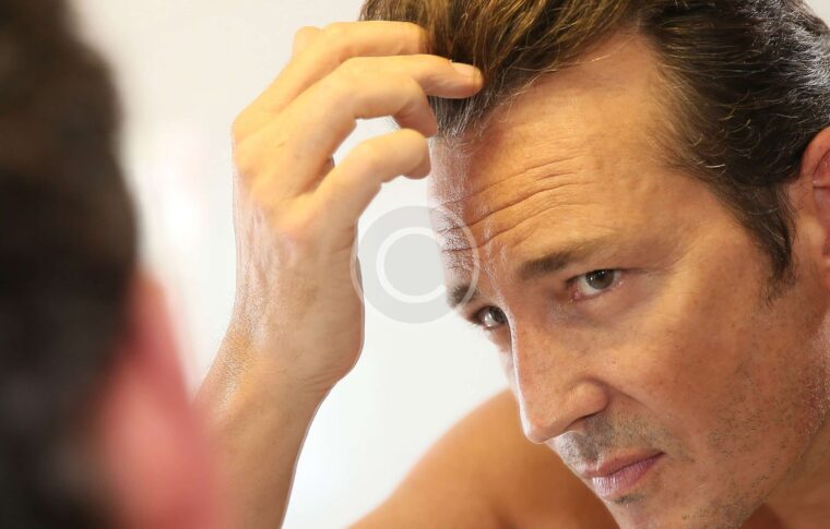 Laser Hair Loss Therapy