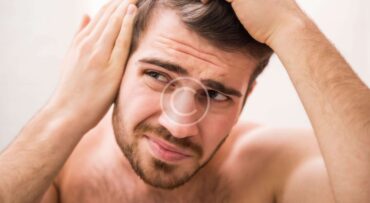 Hair Patch vs. Hair Transplant