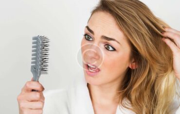 What are the disadvantages of hair bonding?