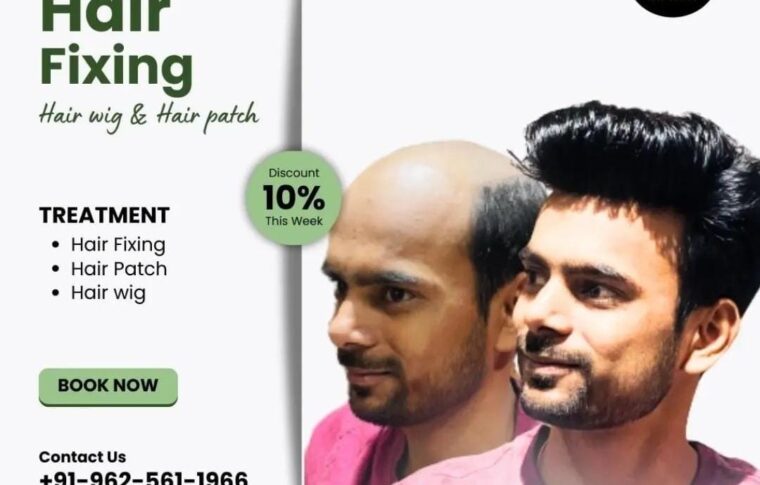 “Hair Patch Services in Noida: A New Hub for Natural Beauty”